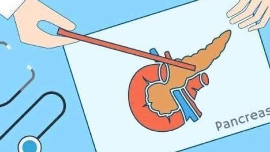 v2-10a95b219abddb5af30f4c7c7cf24d47_1440w.jpg?source=172ae18b