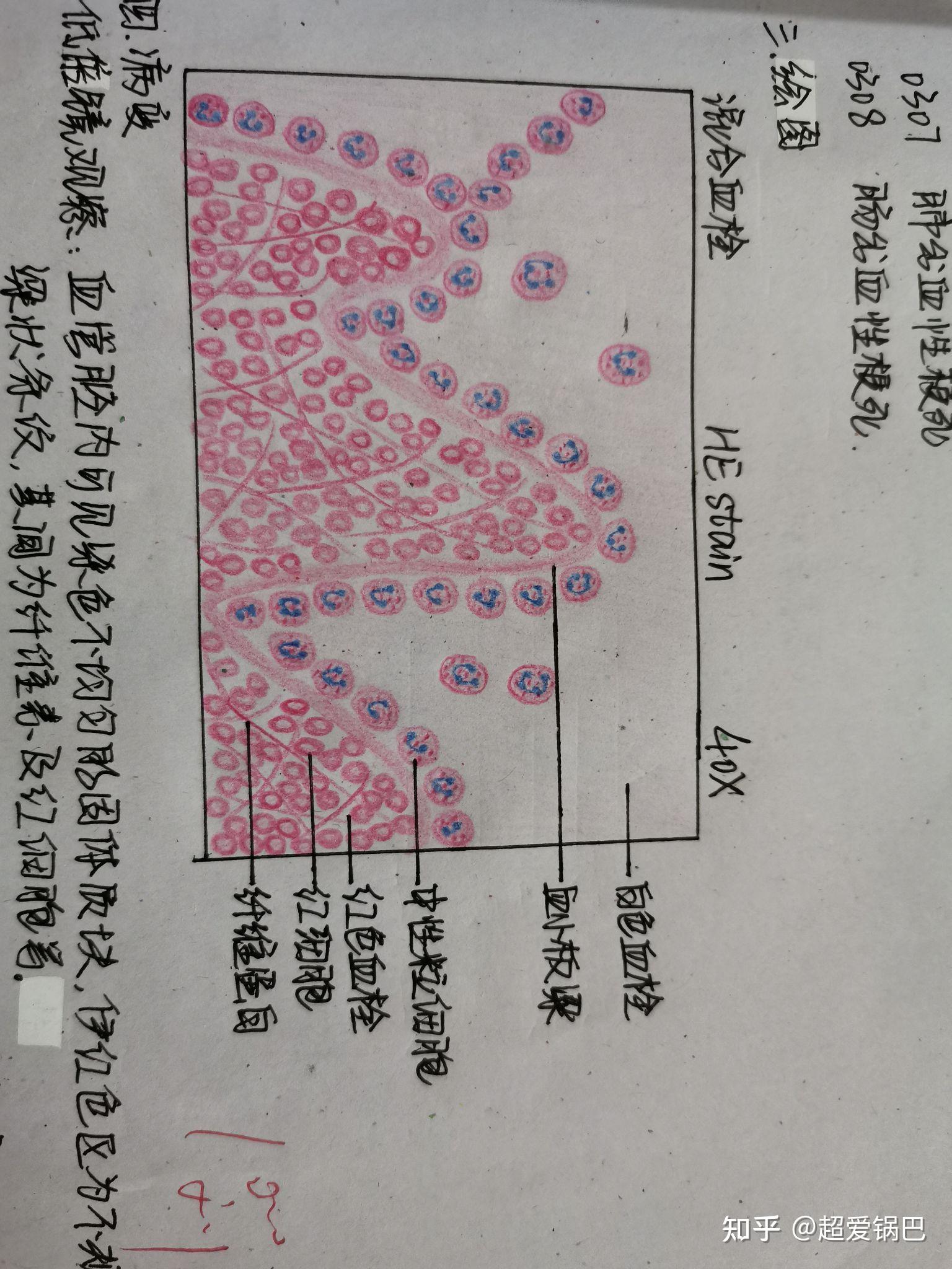 病理学实验报告红蓝铅笔绘图 