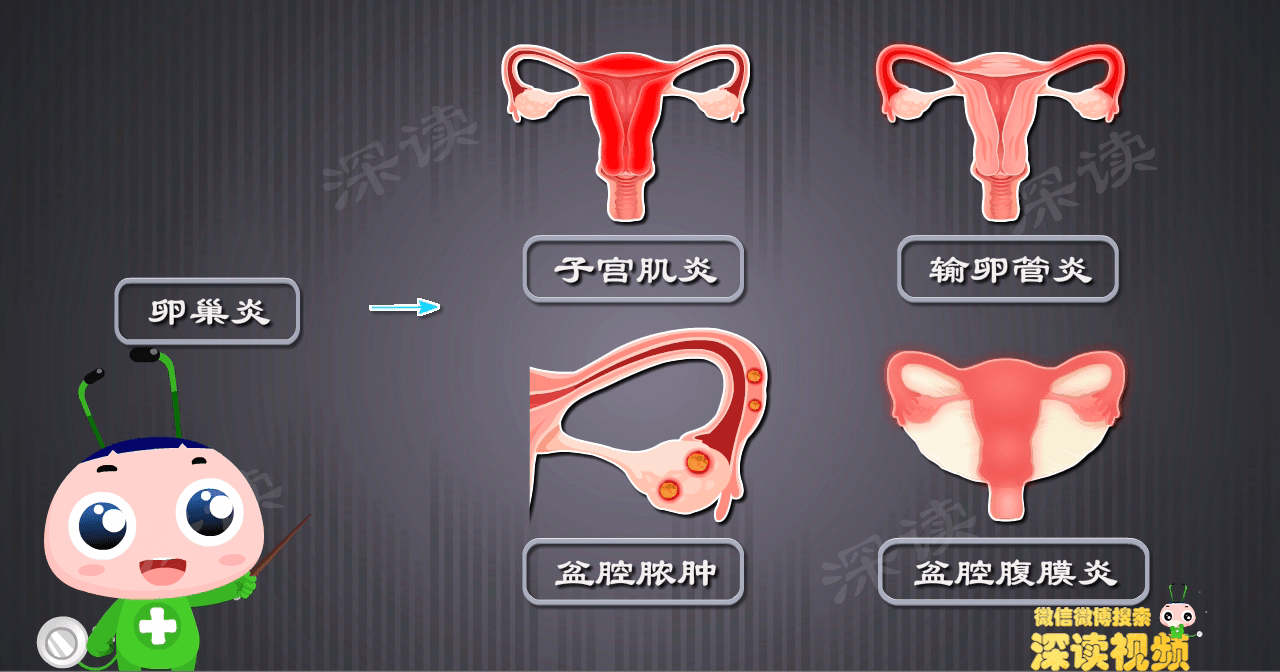 乖乖女竟得附件炎月经不调还不孕动漫揭秘附件炎作妖全过程