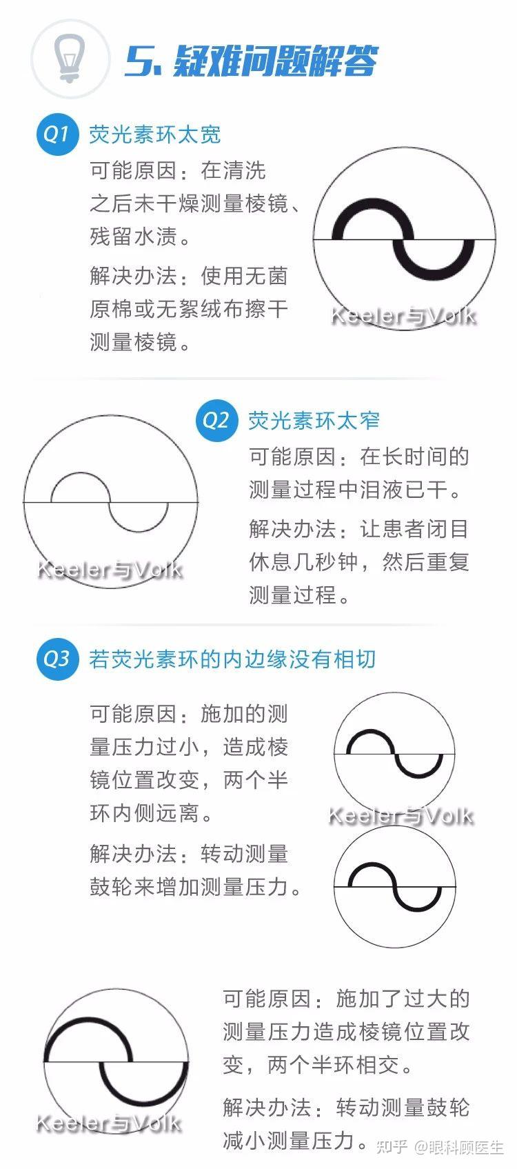 金标准goldmann压平眼压计