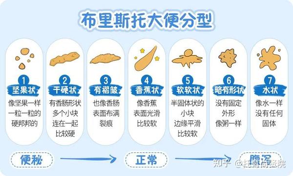 托幼教师一图了解——宝宝便便图谱大全 - 知乎