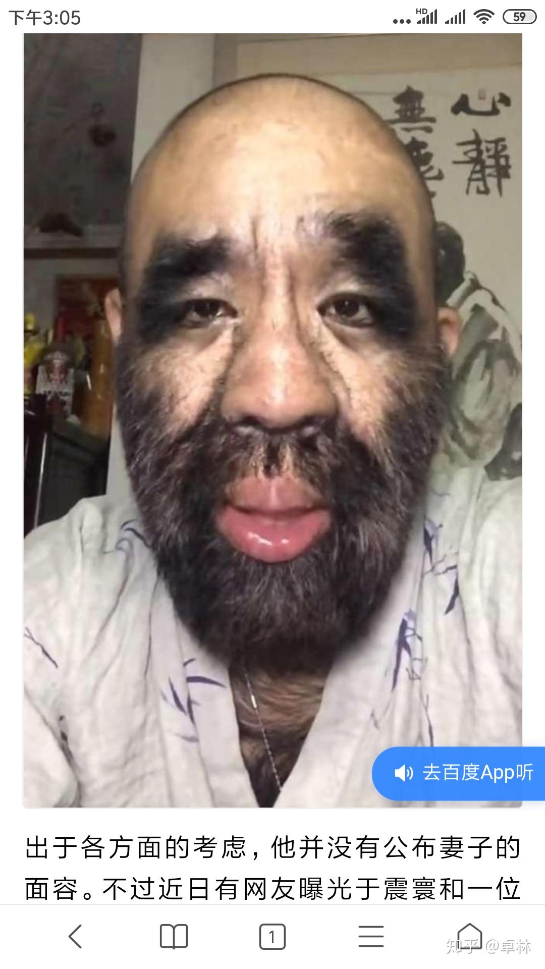 万万没想到中国第一毛孩于震寰居然秃顶了