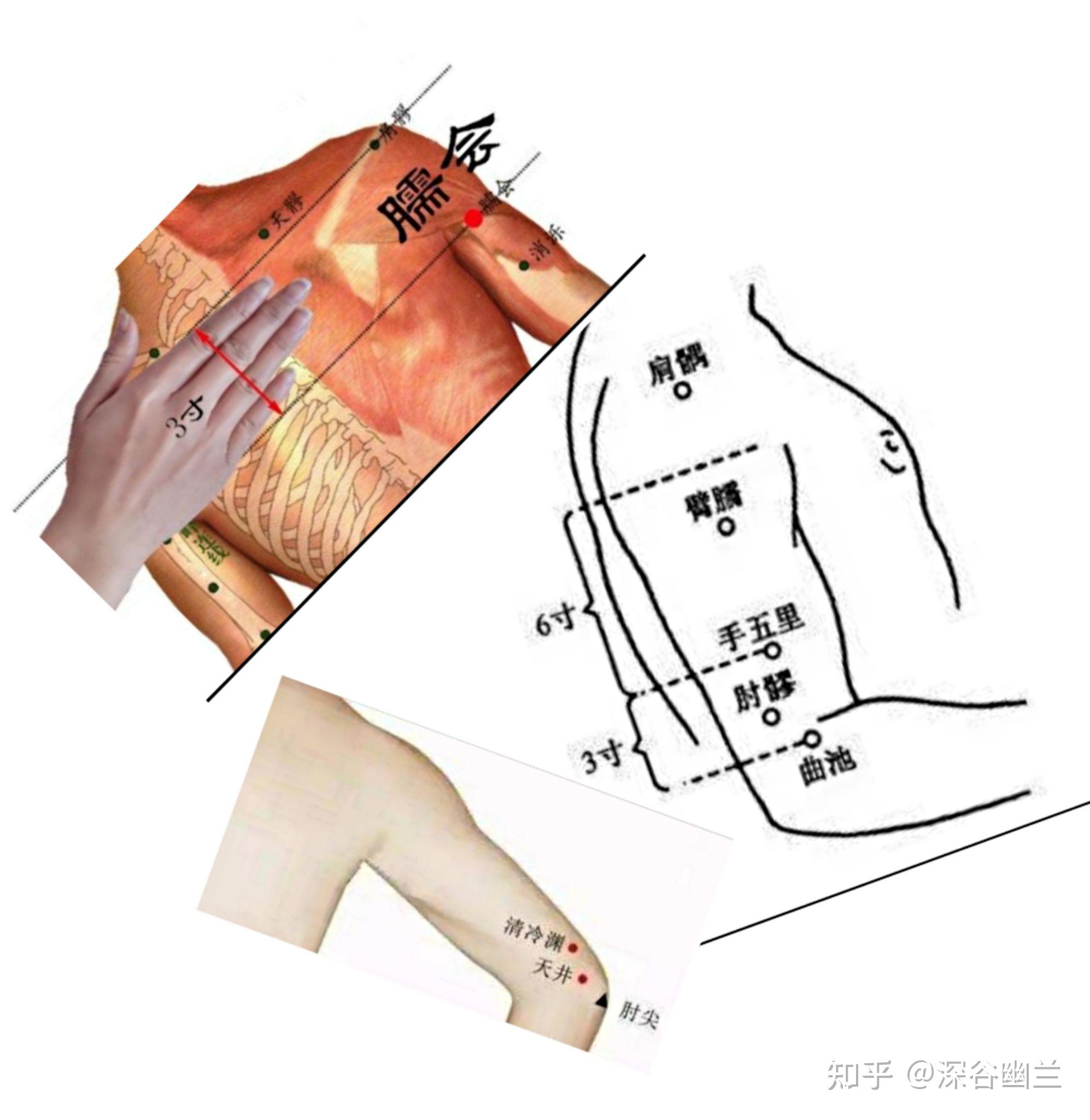 天井穴是肱三头肌第四个激痛点臑会穴是肱三头肌第一激痛点.