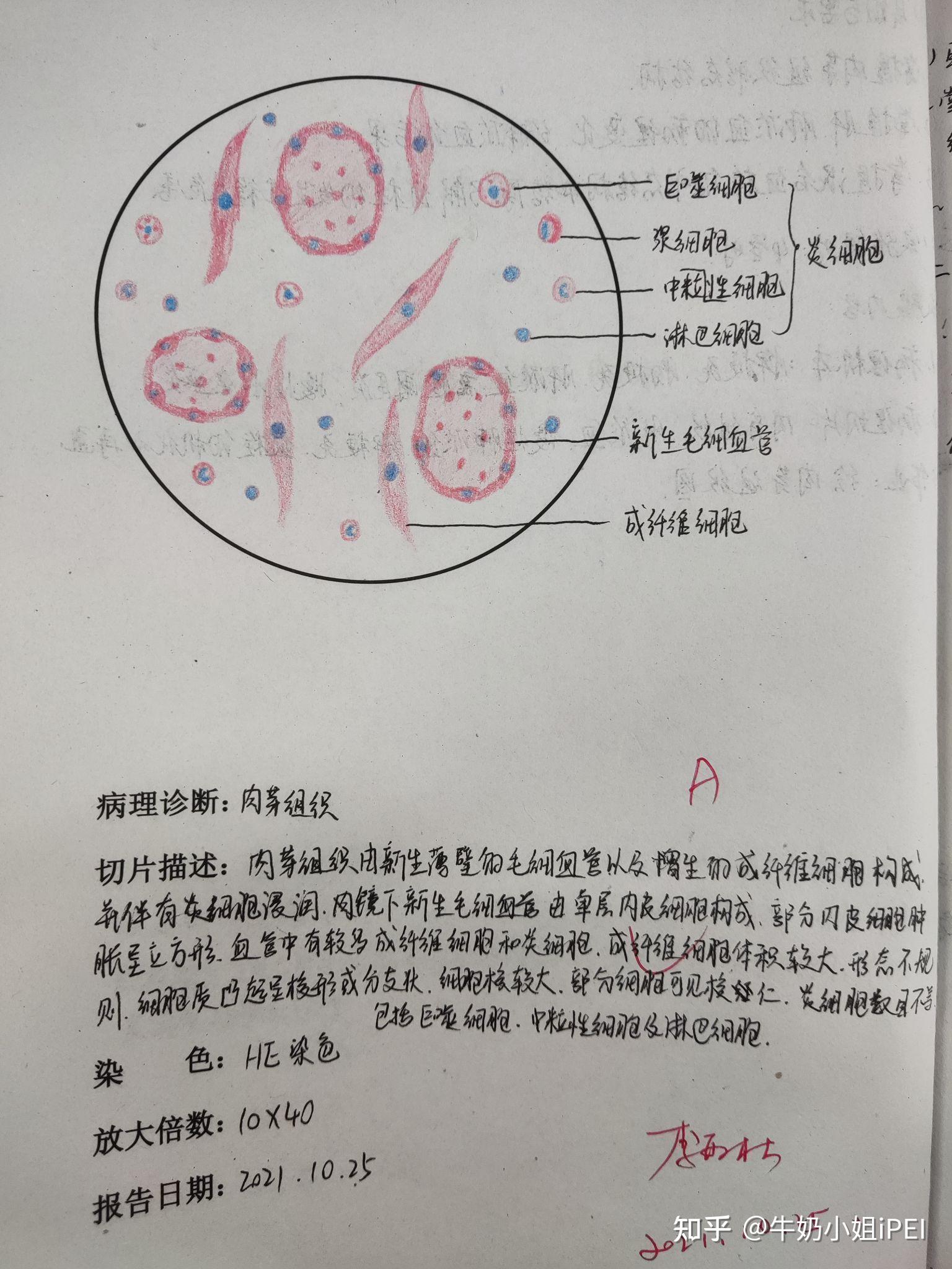 螺形菌红蓝铅笔绘图图片