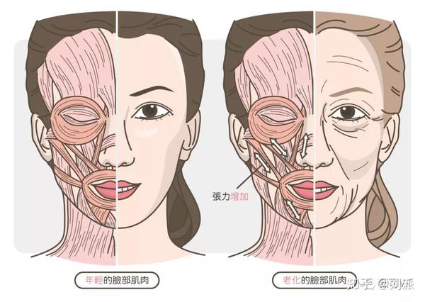 增加筋膜韧带的机械强度,延缓组织的衰老松弛,使得面部组织在与重力的