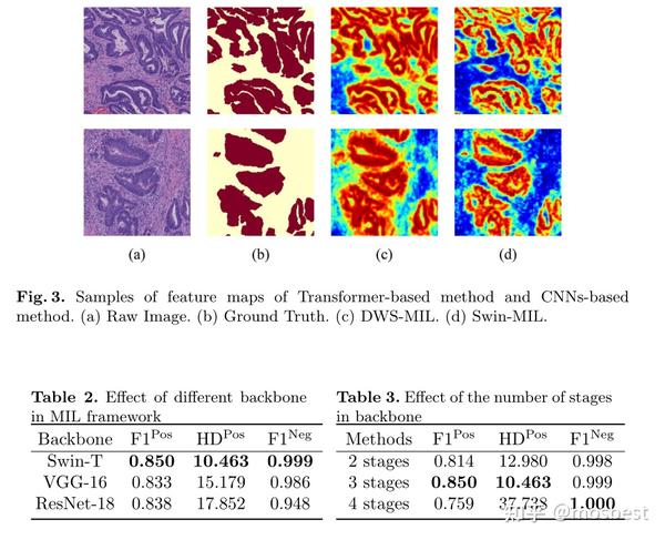 Transformer Based Multiple Instance Learning For Weakly Supervised ...