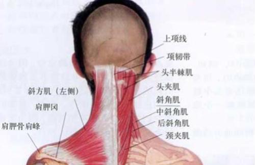 脖子疼 不一定是颈椎病 可能是颈肌劳损 知乎