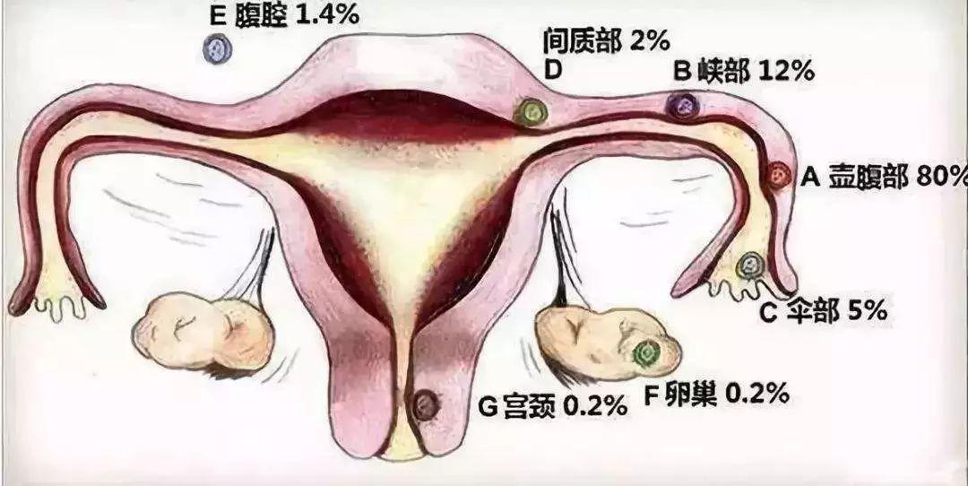 宫角位置图片图片