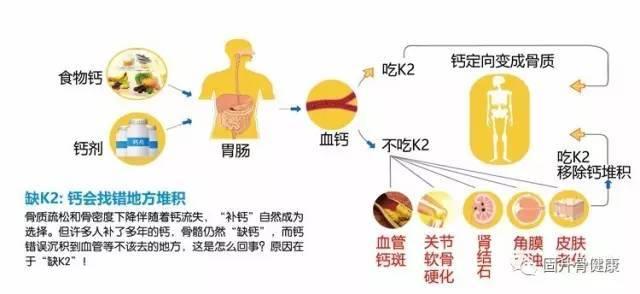 50出头的中年人如何选购补钙产品?