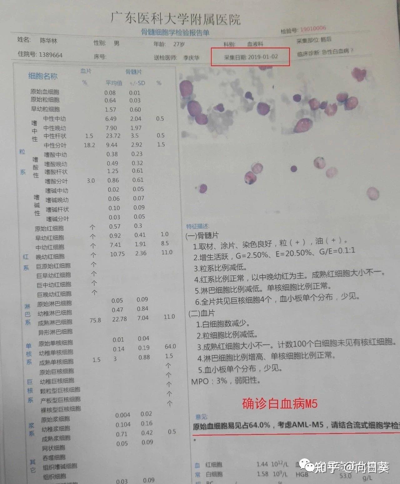 確診白血病m5 - 知乎