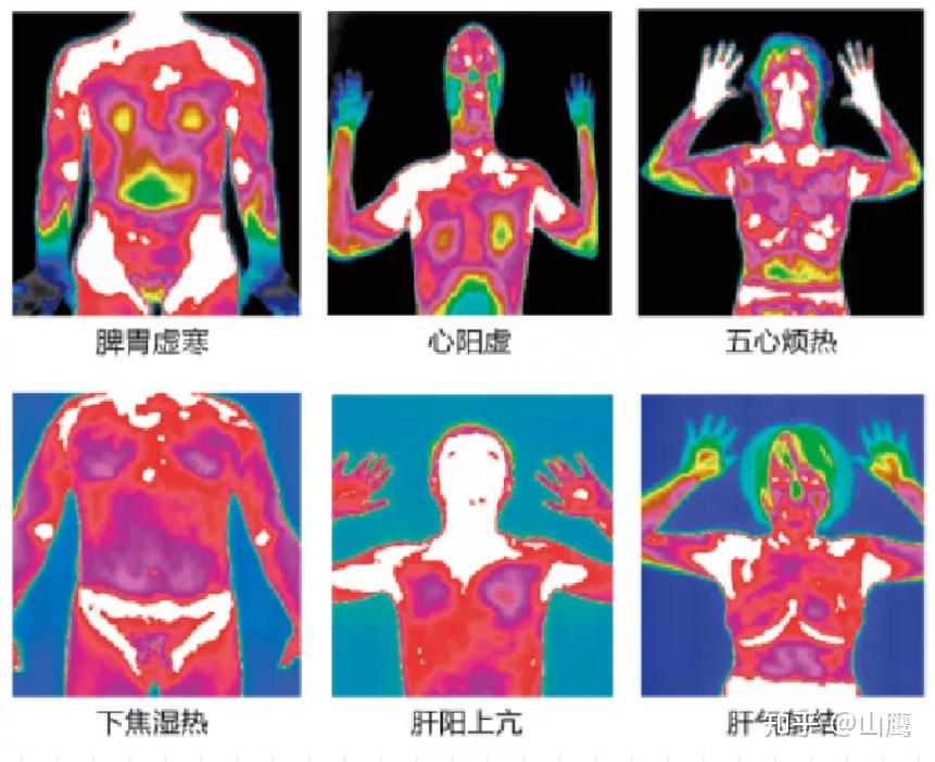 您的健康体检红外热成像升级了华景康红外邀您体验中医红外智能体检热