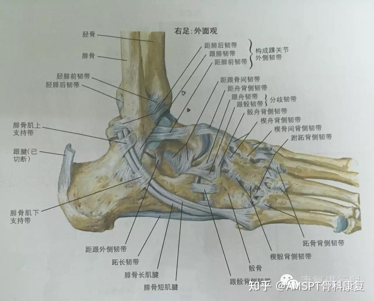 特殊韧带损伤——前胫腓下韧带     特殊损伤体征为: 患者外踝可见
