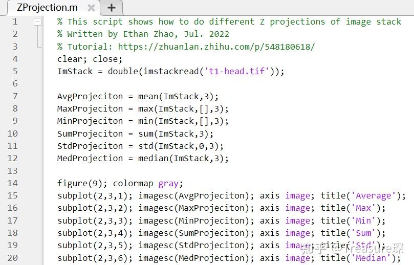 Matlab Image Projection MATLAB科研图像处理——图像堆栈Z projection - 知乎