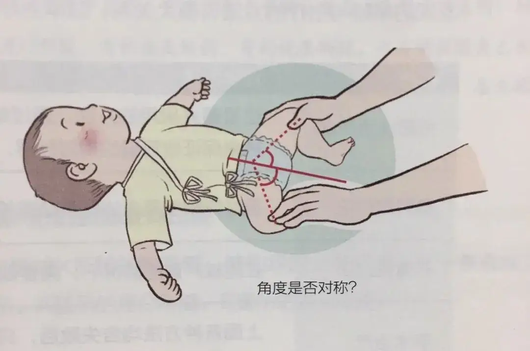 带图3岁孩子腿部畸形只因一个习惯90父母都没在意