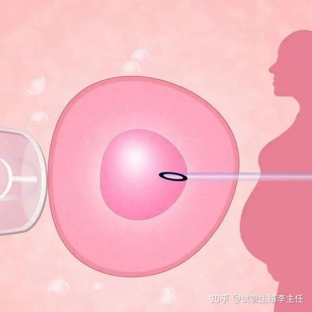 促排会早衰?闭锁卵泡了解一下 - 知乎