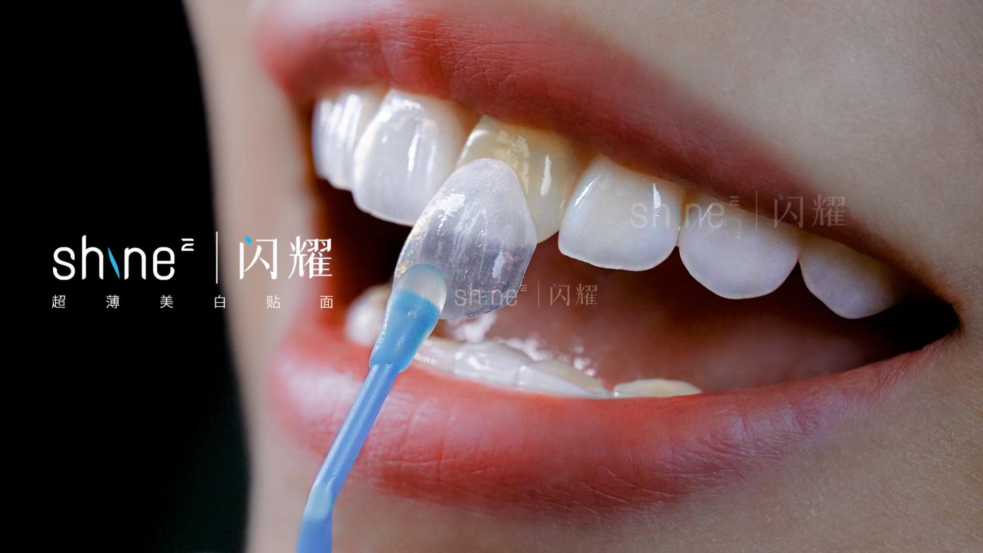 前牙大面积龋坏的树脂修复一例
