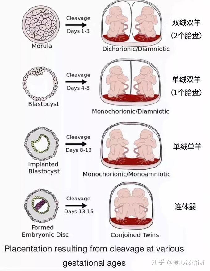 试管双胞胎是单绒还是双绒