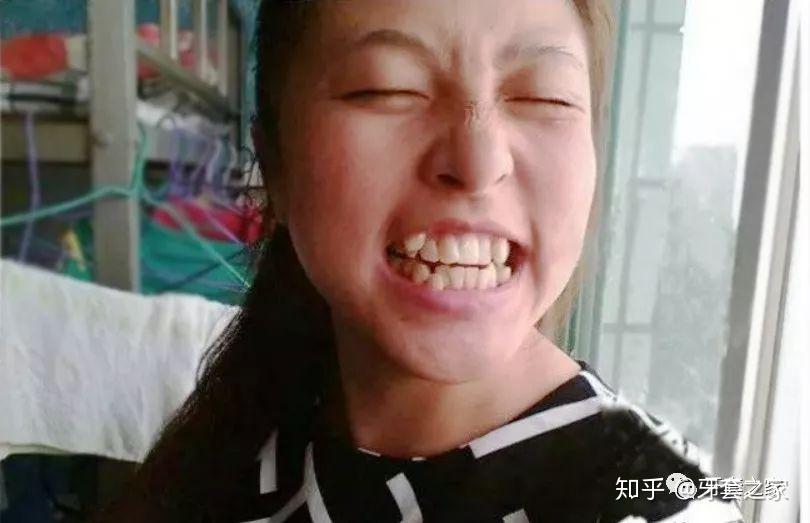 牙齿是不是很恐怖看了晚上会做噩梦是怎样心情