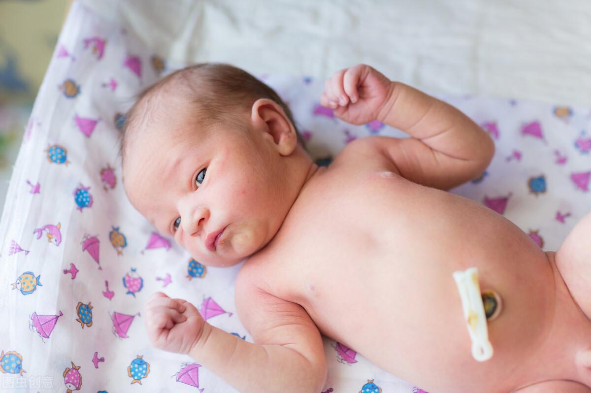 1个月婴儿肚脐正常图片（宝宝的肚脐很娇弱）-幼儿百科-魔术铺
