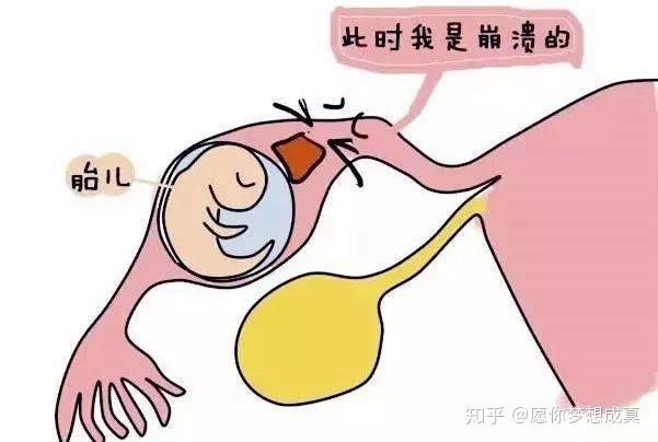 医院检查是否怀孕 v2-13b7ca562711774fcb90fcddb786e6bd_r.jpg