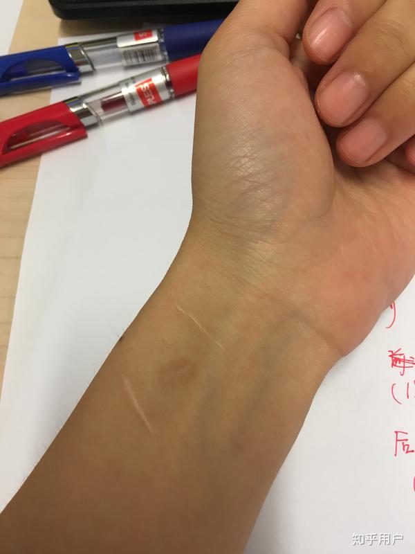 不要在这里说出来,最后决定还是放过自己,放过他吧 上图中的两道刀痕