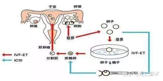 试管婴儿和普通婴儿的差别 答案让你意想不到 知乎