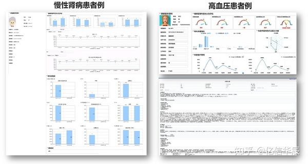 详解医疗大数据的分析与应用 - 知乎