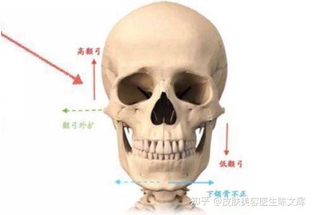 左右脸不对称一边大一边小该怎么办