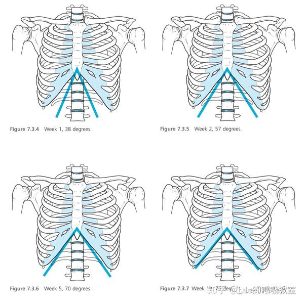 风靡全球的肋骨外翻矫正方法 知乎