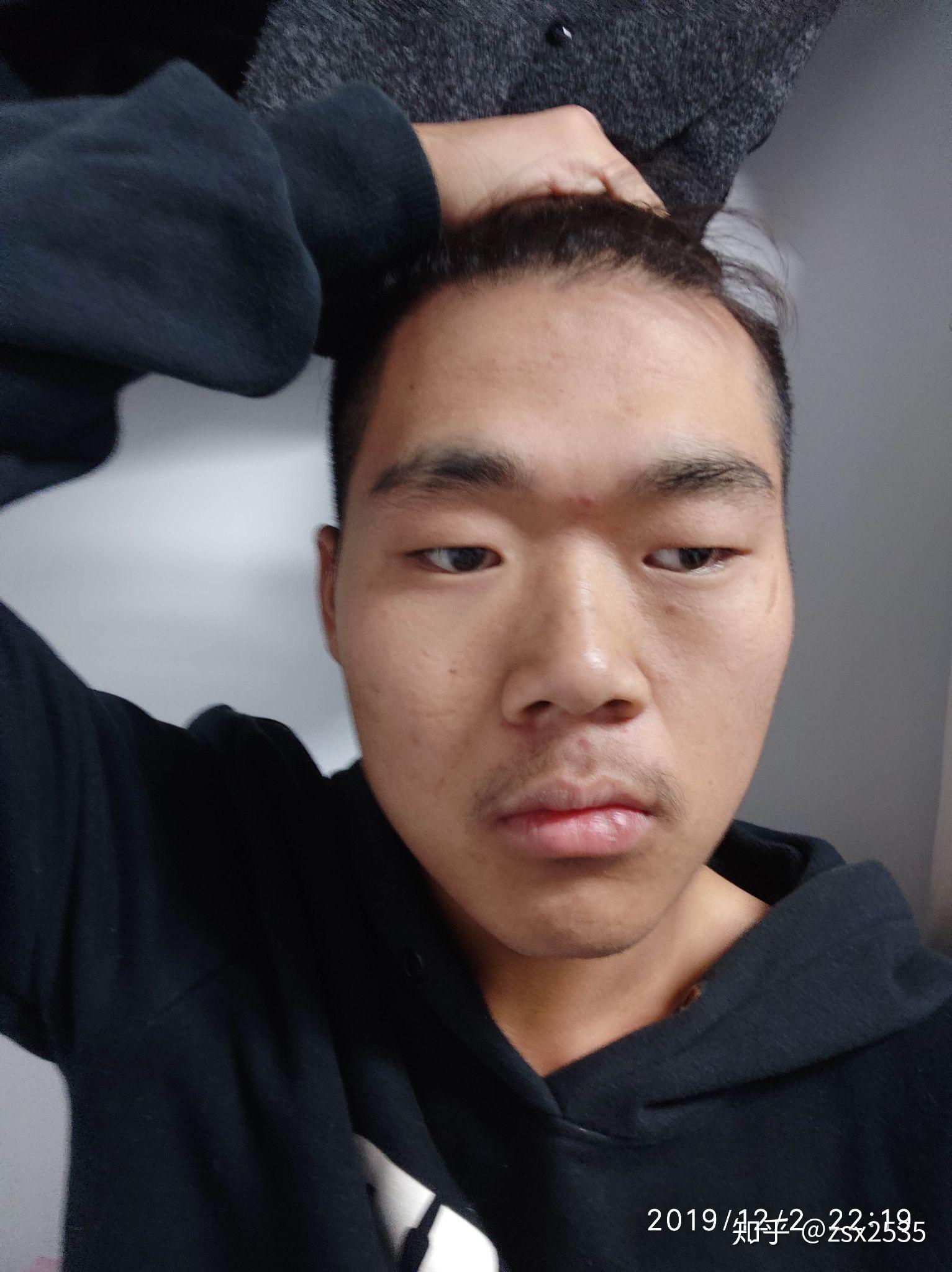 男生长得丑还留长发是什么体验