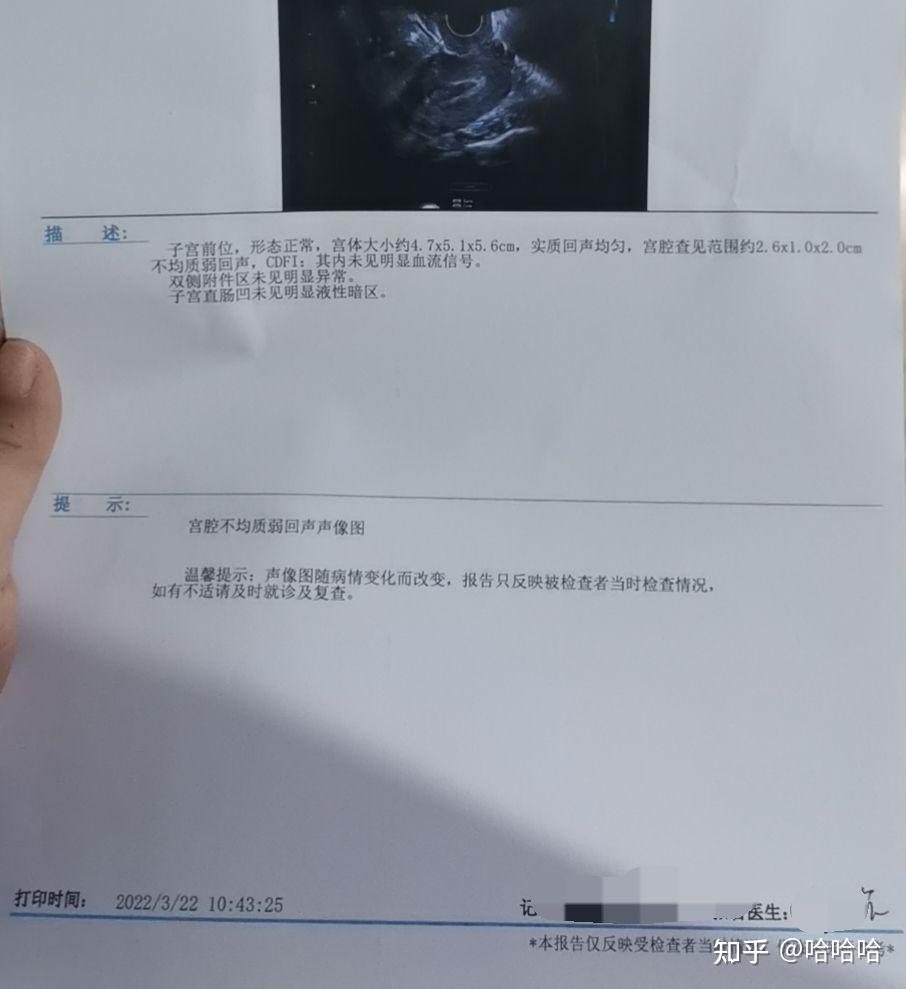 药流经历给一些姐妹参考