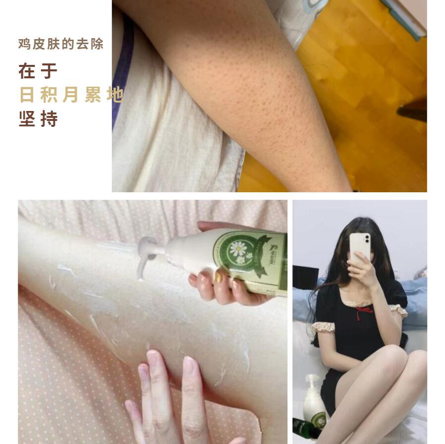 包含请问怎么去除鸡皮肤啊的词条