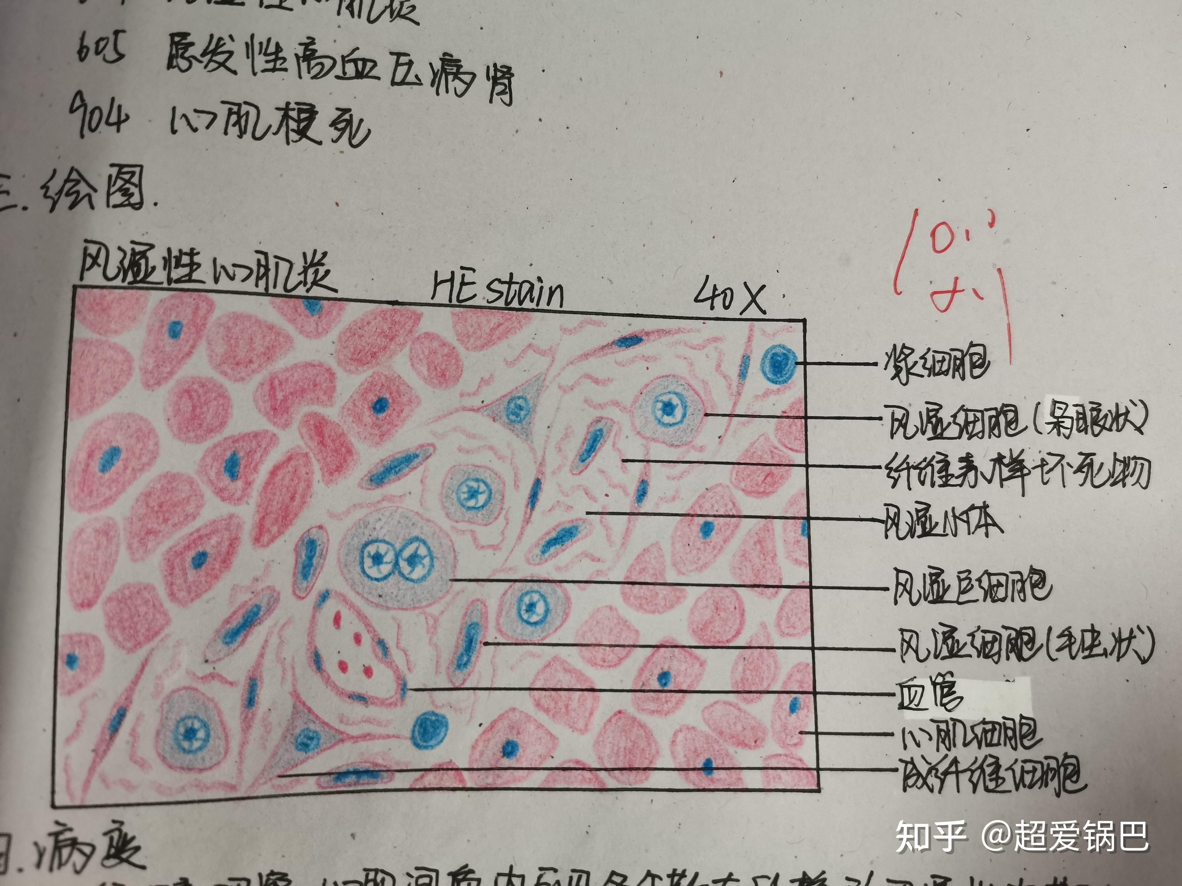 螺形菌红蓝铅笔绘图图片