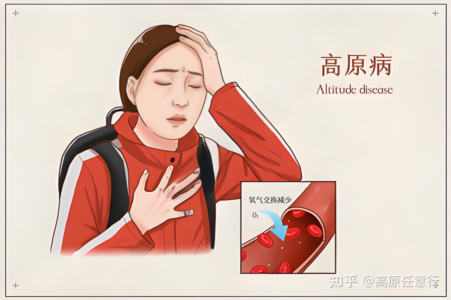 如何判断自己是否高反:高原反应的自我诊断指南 - 知乎