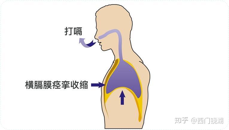 怀孕怎么看腹直肌分离 v2-14ce7c2bfde9ac889532e9dc18d5e84d_r.jpg