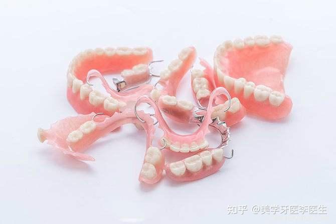 一种可以随时从口腔内拿出来的假牙,需要在邻牙挂钩子以起到固定作用