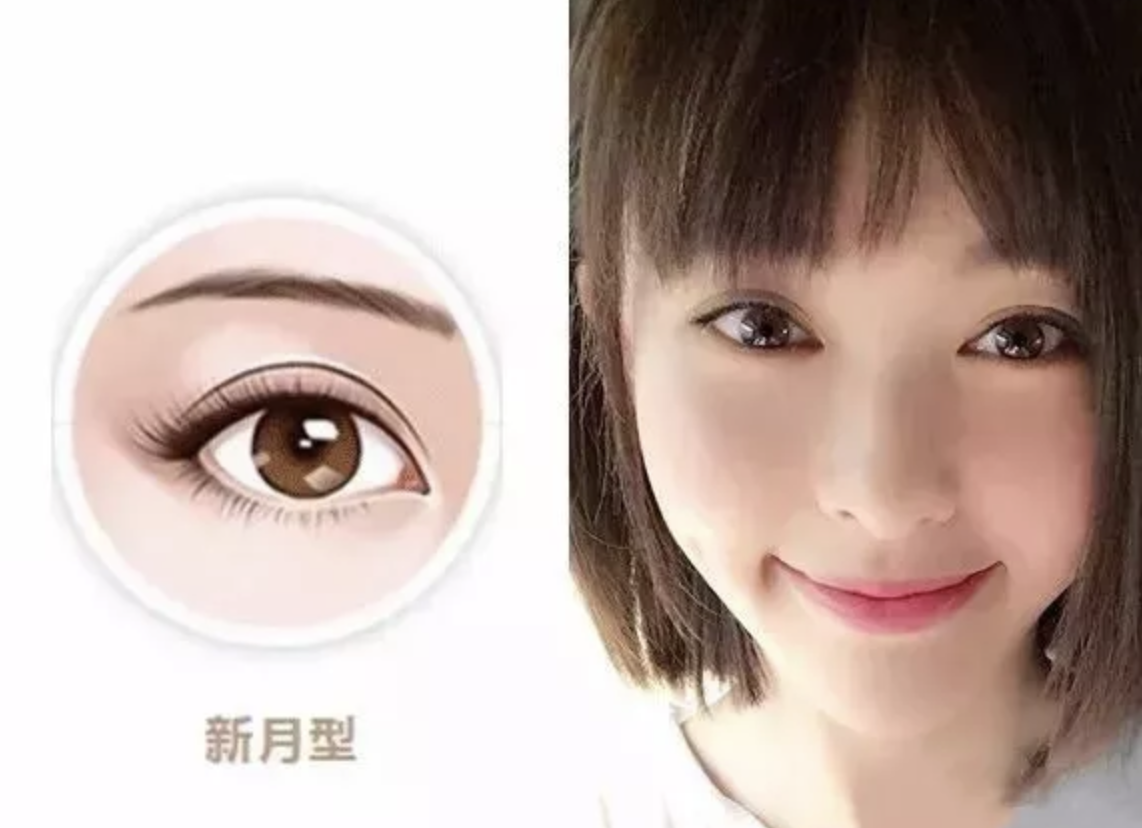 同样都是双眼皮为什么气质差那么多如何找到适合自己的双眼皮