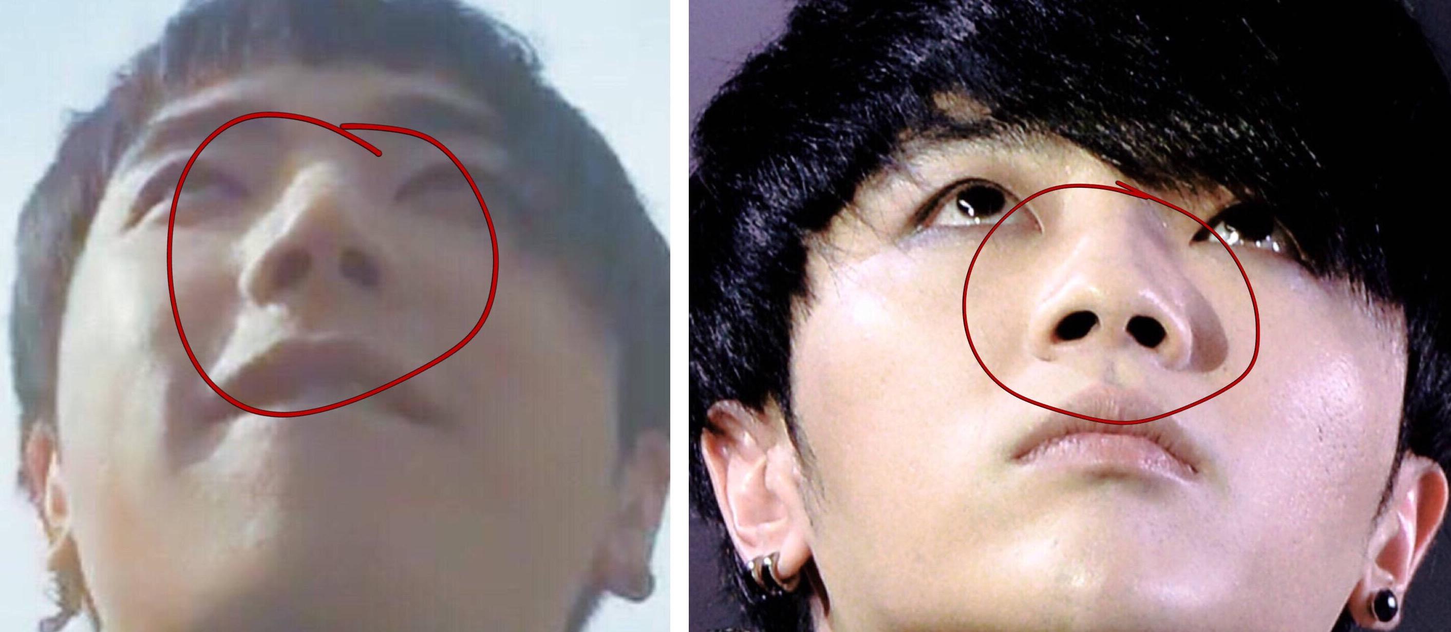 华晨宇有没有整容?