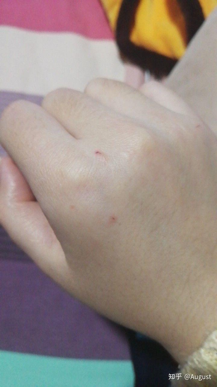 酒精消毒多少时间一次 v2-1535611c27fe1d7b047084fb9ae8ee8d_r.jpg