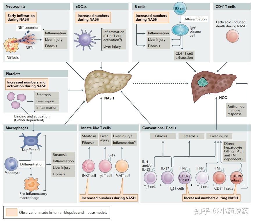 非酒精性脂肪性肝炎的免疫細胞介導特徵