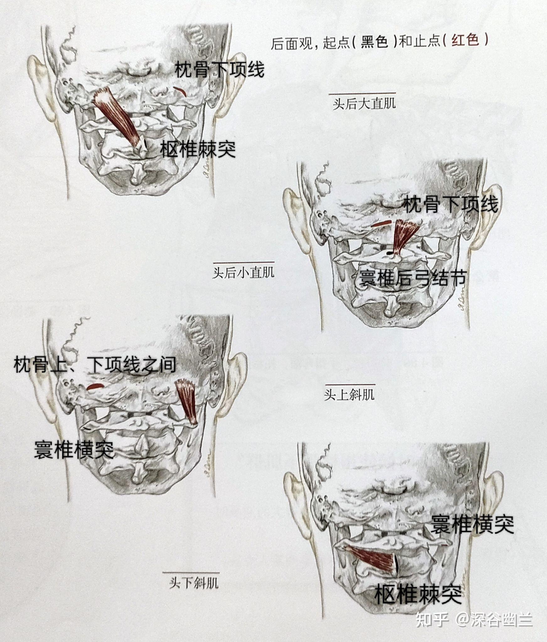 减小之后,转头颈部的时候更容易出现转头疼痛或活动受限,枕下肌群紧张