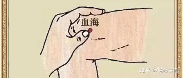 放血疗法大全== - 知乎