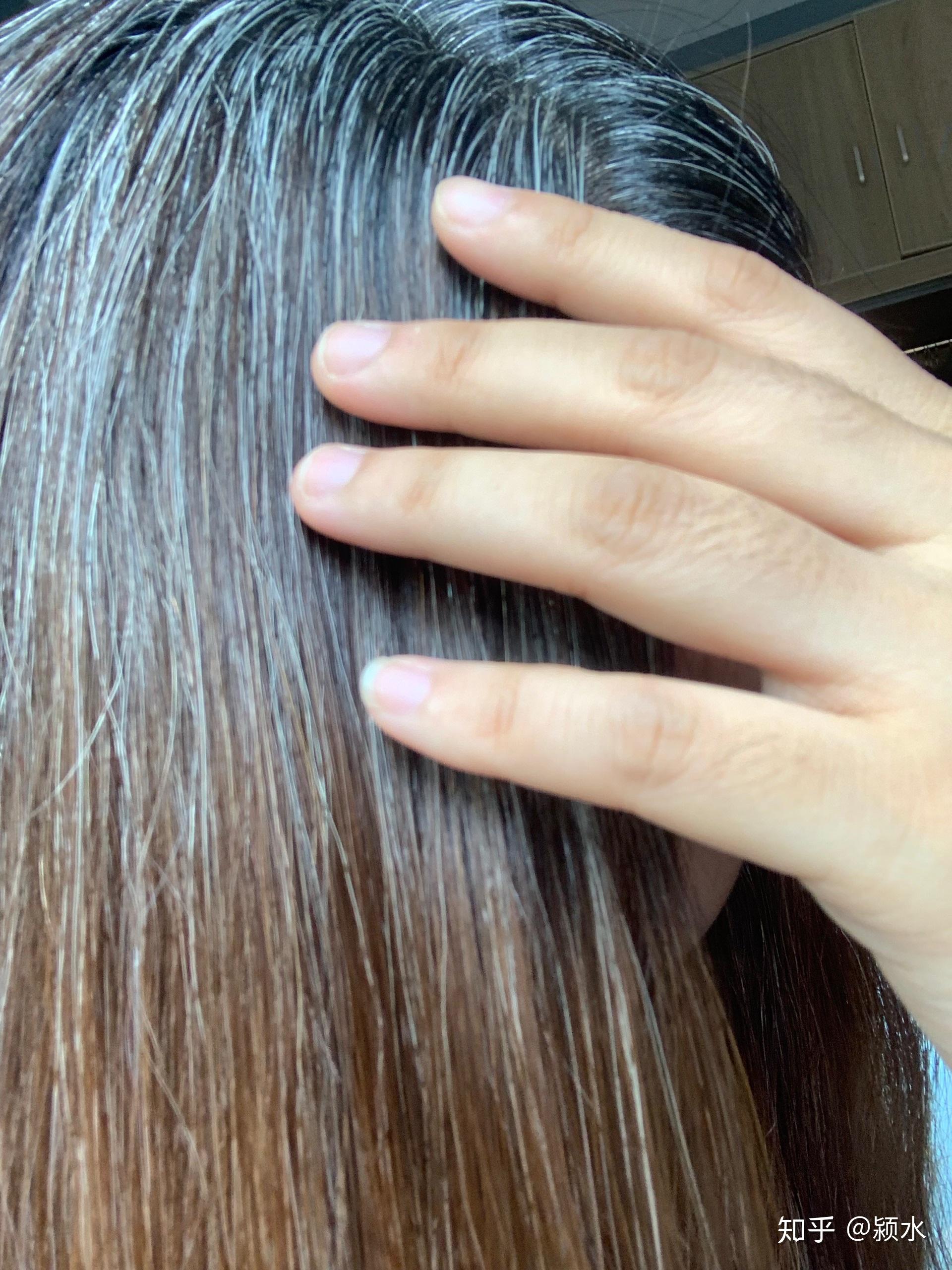 女生少年白 我很自卑 怎么办 才16岁 自我感觉很痛苦?