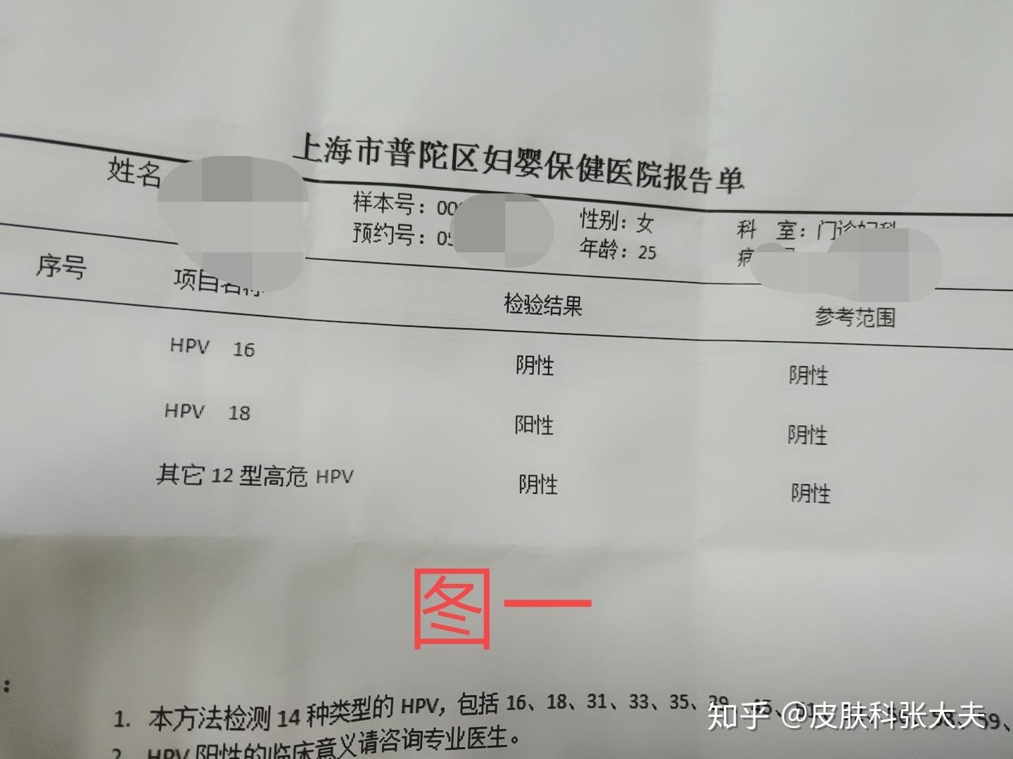 上海金女士hpv18型高危转阴病例分享