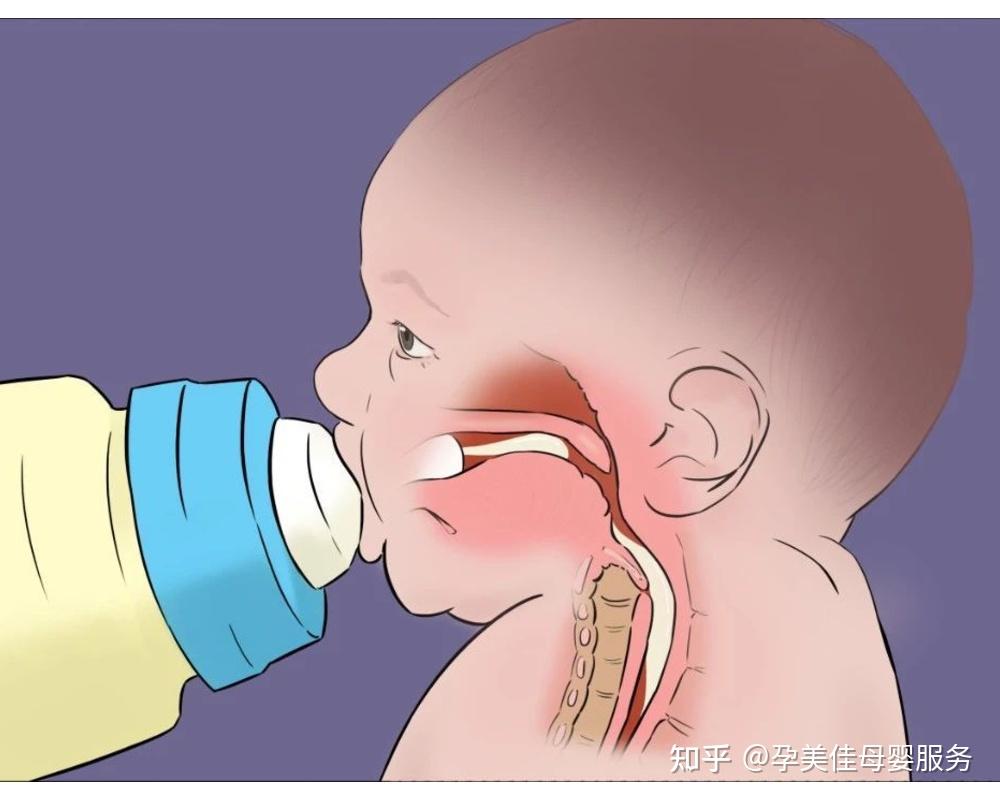 宝宝呛奶第一时间怎么做抓住黄金4分钟别让悲剧再发生了