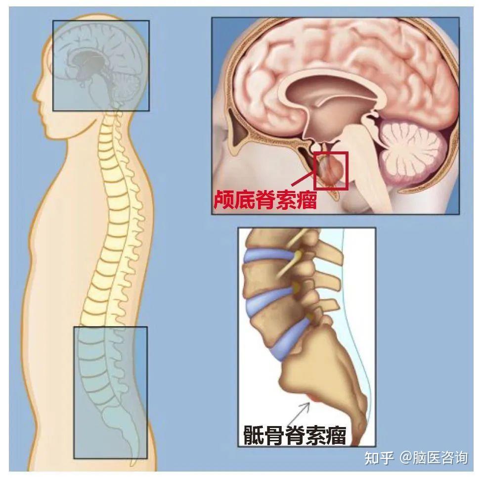 颅底的位置图片