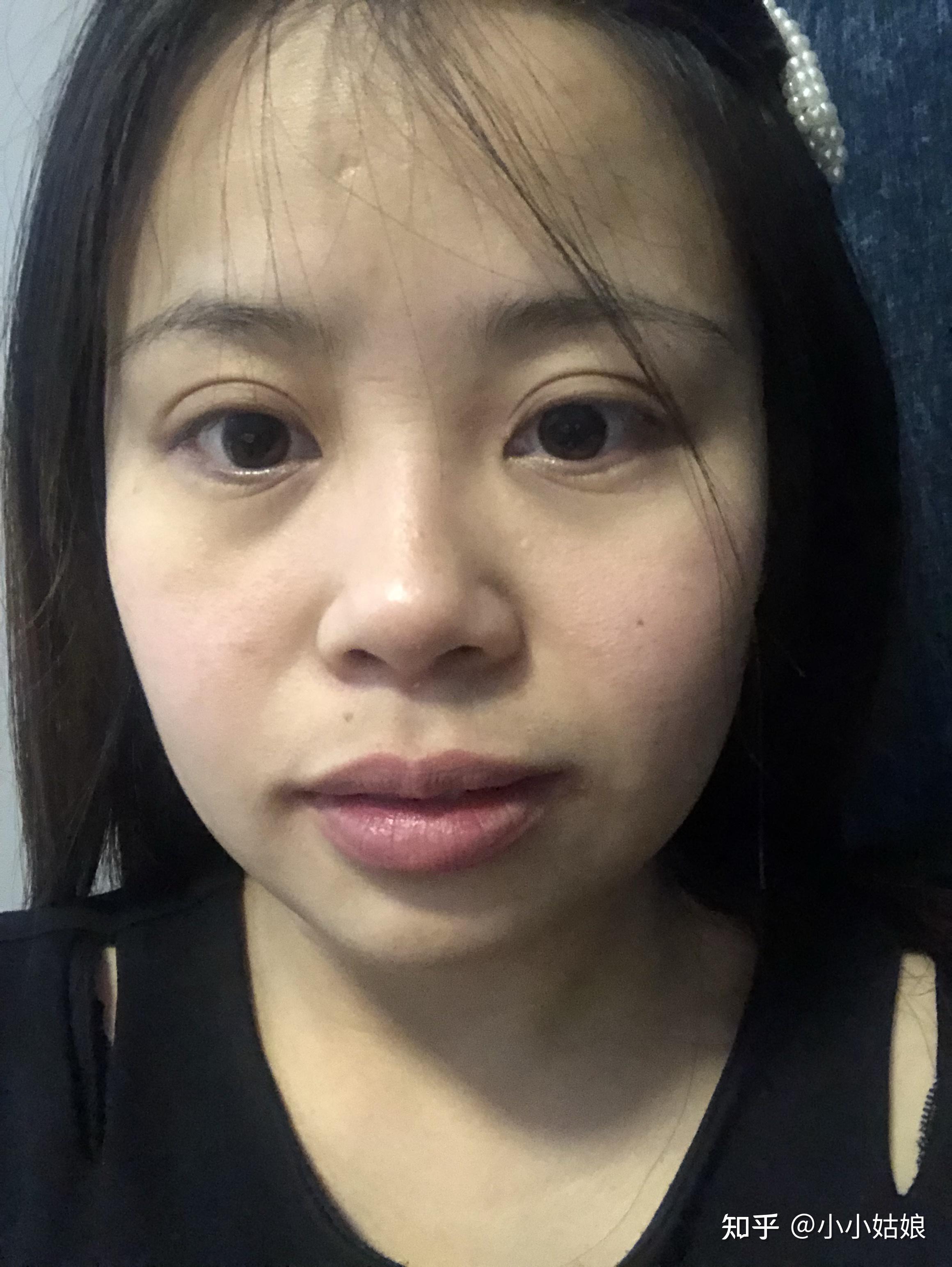 整牙变丑了 - 知乎