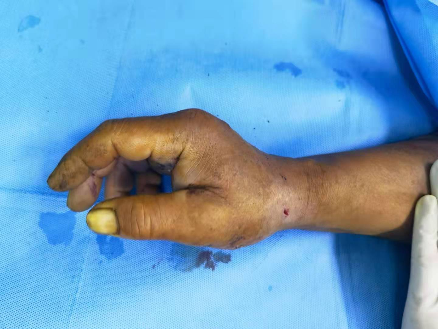 东北大哥太爱玩学人用鱼镖射鱼结果第一镖就射右手上了