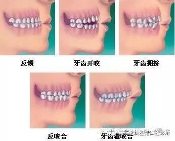 v2-16411c69127cf107d6ee813cdc8f38c1_b.jpg