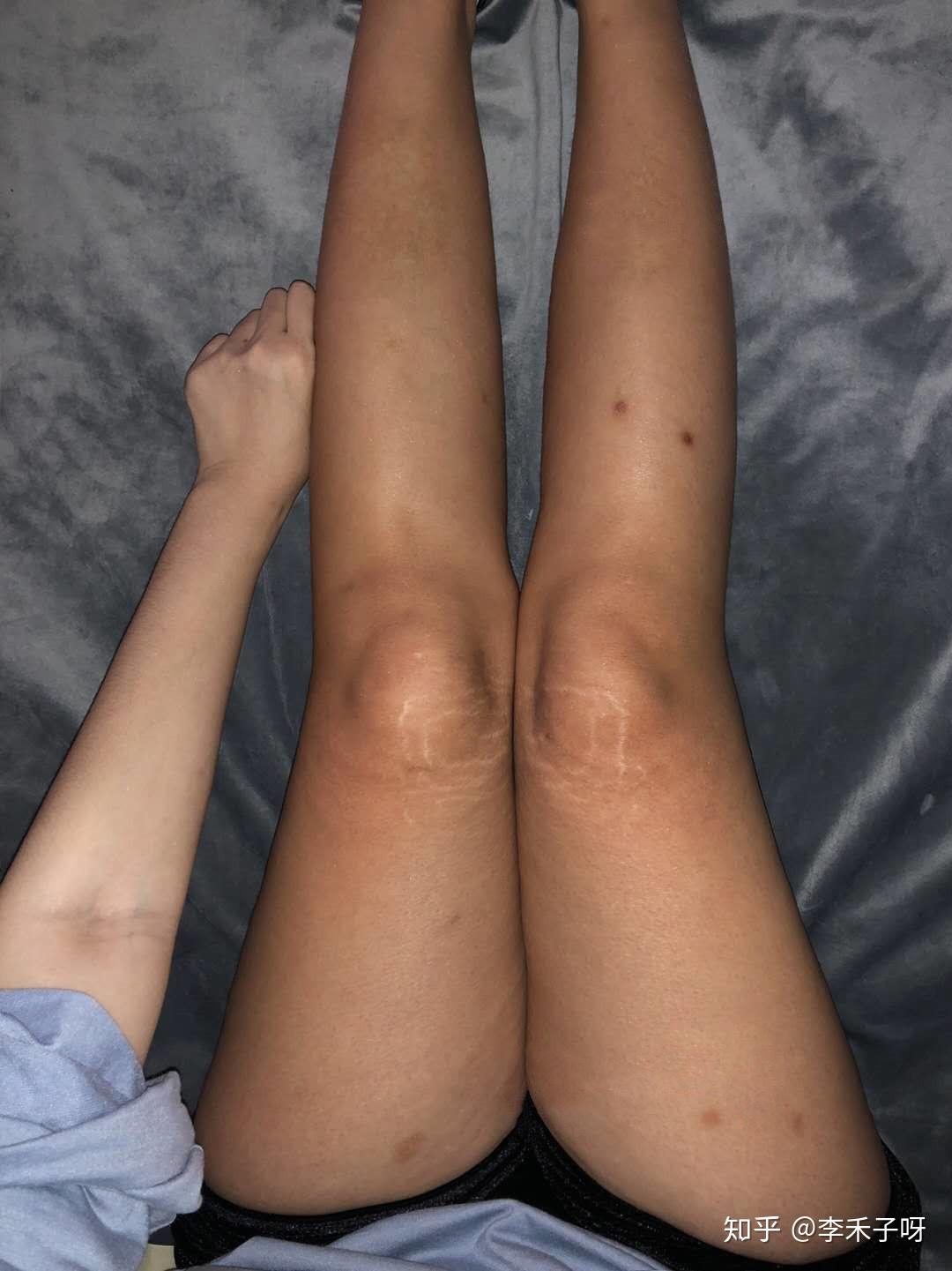 怎样快速减肚子和大腿上的肉 v2-16457c5d6d486a78f402c4d2d322f9ad_r.jpg